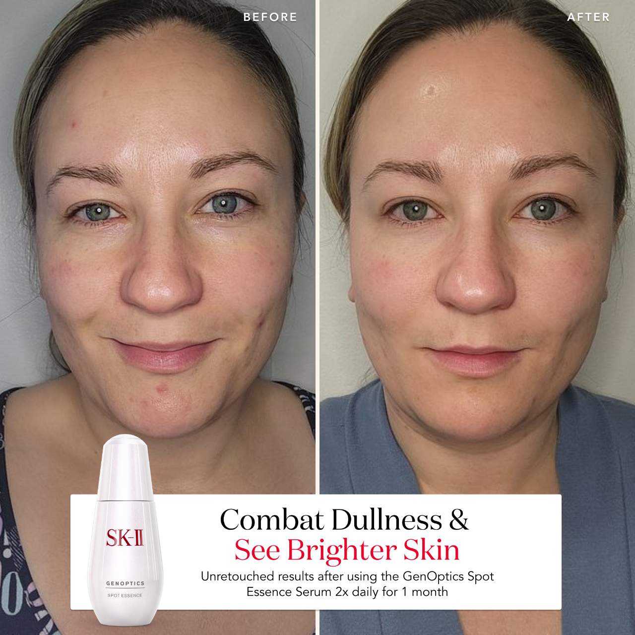 Genoptics Spot Essence Serum | Cosmopolitan Shop