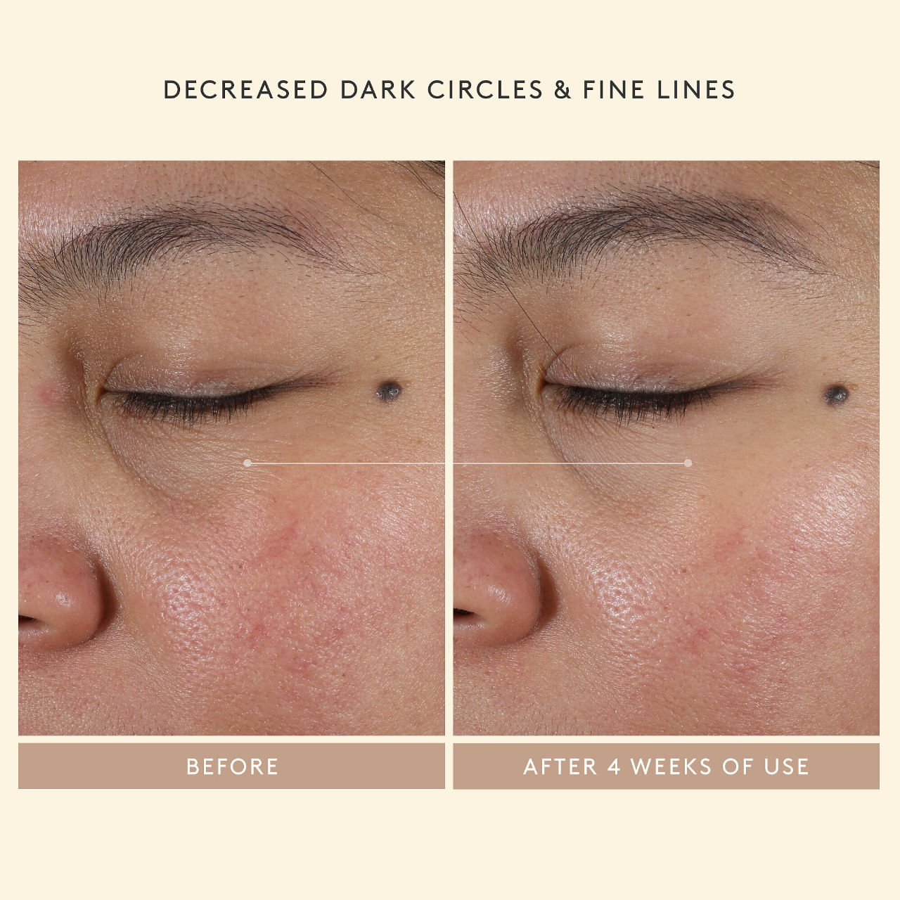 Intensive Eye Renewal Cream With Firming Peptides