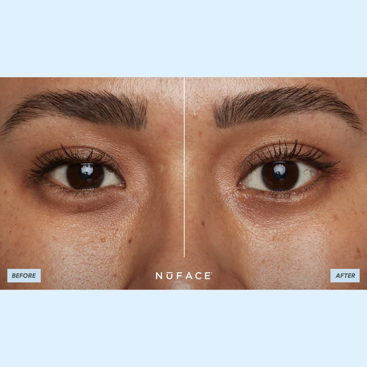 Nuface Ionplex® Hydra-gel Power Patches | Cosmopolitan Shop