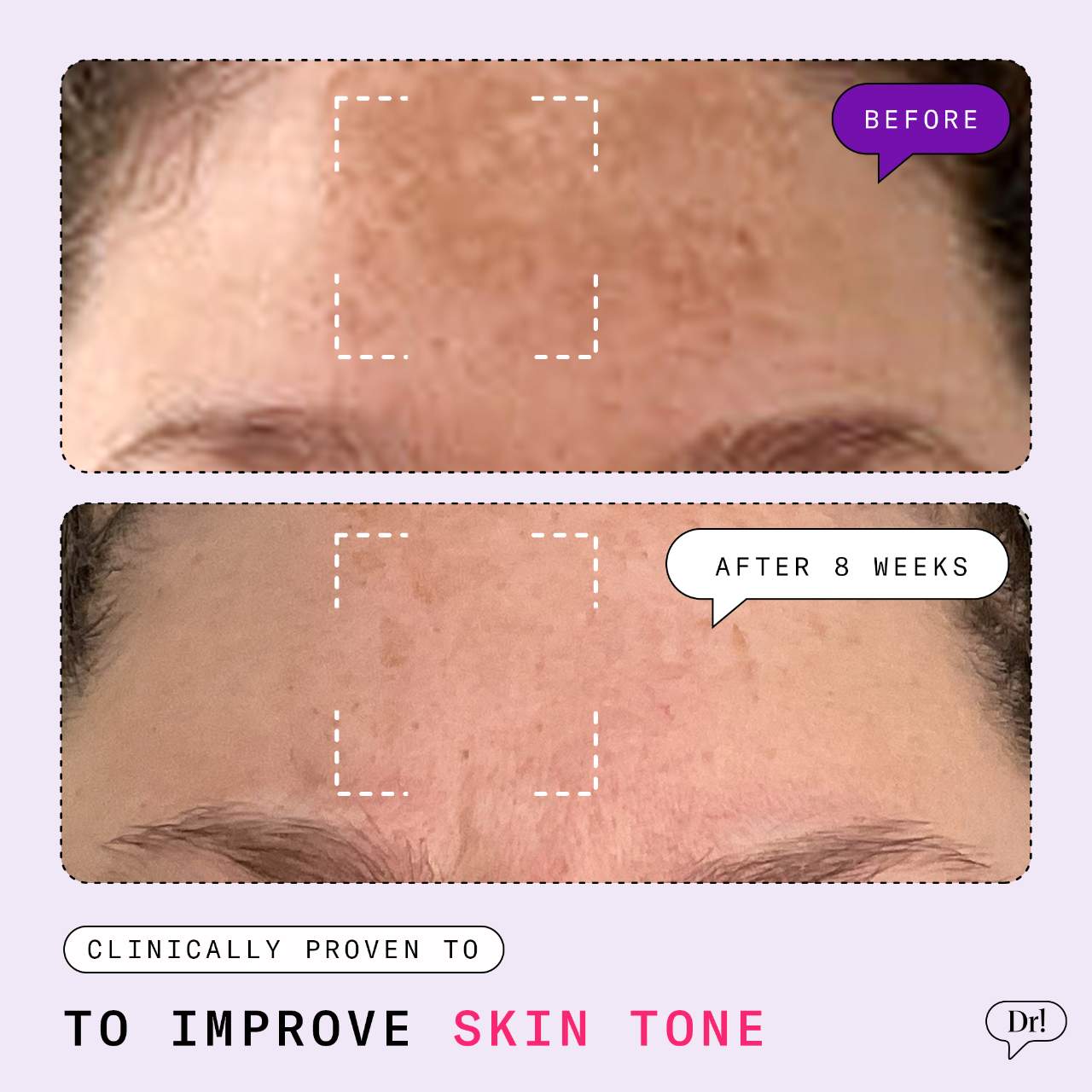 Major Fade Hyper Serum Dark Spot Treatment | Cosmopolitan Shop Major Fade Hyper Serum Dark Spot Treatment | Cosmopolitan Shop