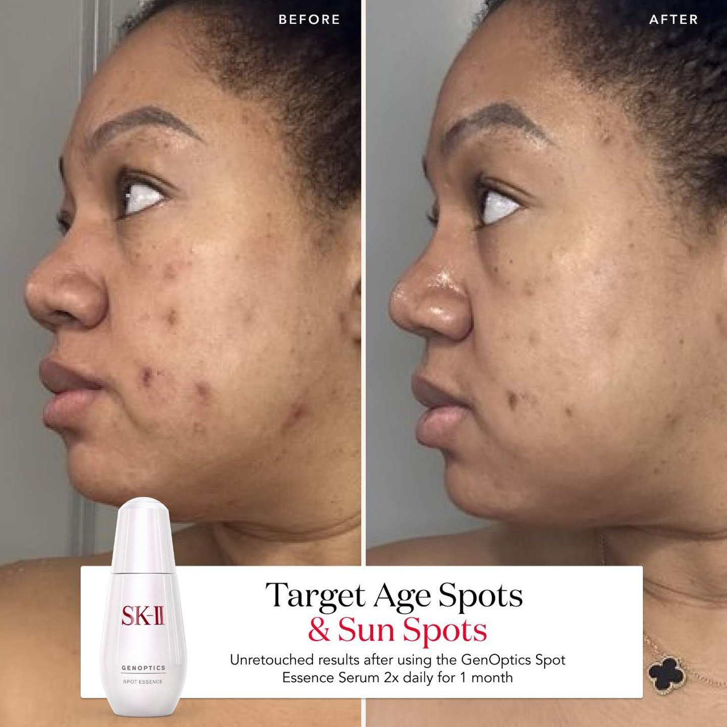 SK-II GenOptics InifinitAura Essence – Everglow Cosmetics
