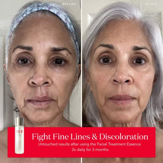 フェイスクリーム Sania BUNDLE DEAL Facial Treatment Essence & GenOptics Ultraura